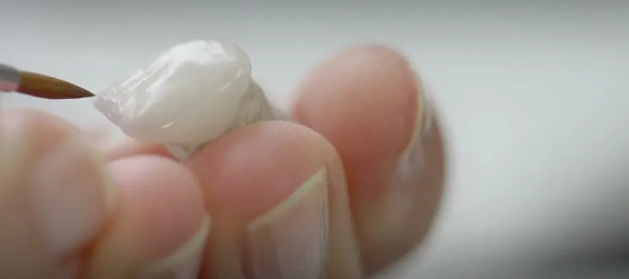 Trabalhos de prótese dentária do PHI Dental Lab, laboratório em São Paulo
