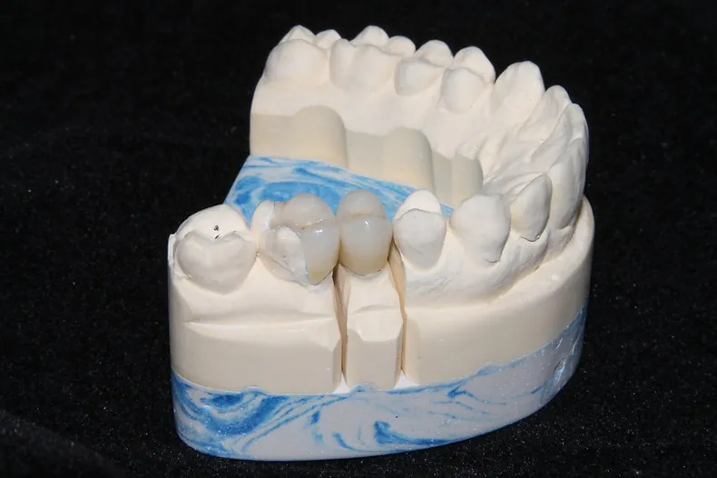 Fluxo digital e analógico convivendo no PHI Dental Lab